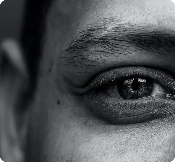 Vision